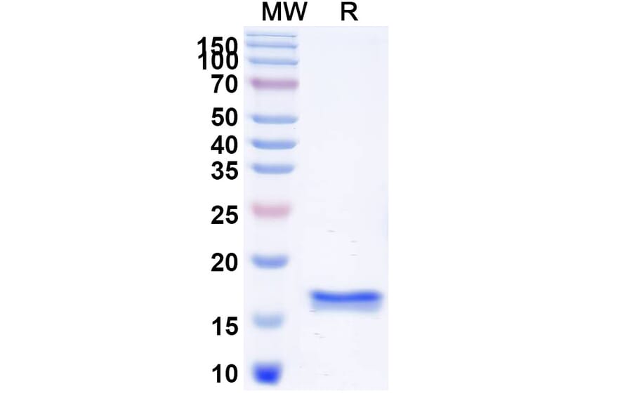 SDS-PAGE - Anti-CD45 Nanobody [2H7] (A338337) - Antibodies.com