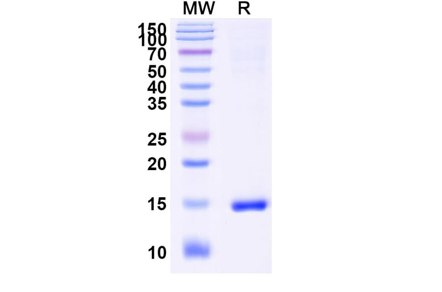 SDS-PAGE - Anti-Caspase-3 Nanobody [VHH1] (A338338) - Antibodies.com