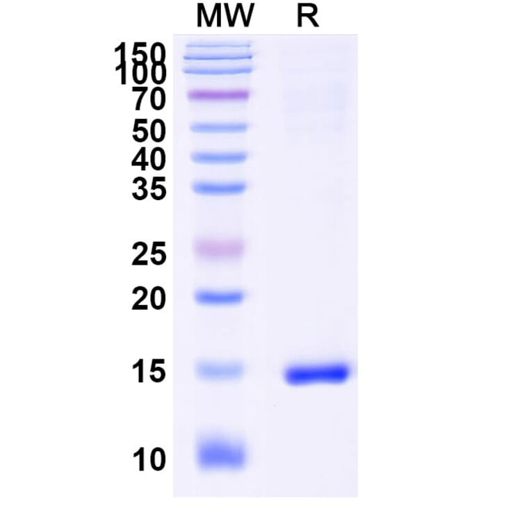 SDS-PAGE - Anti-Caspase-3 Nanobody [VHH1] (A338338) - Antibodies.com
