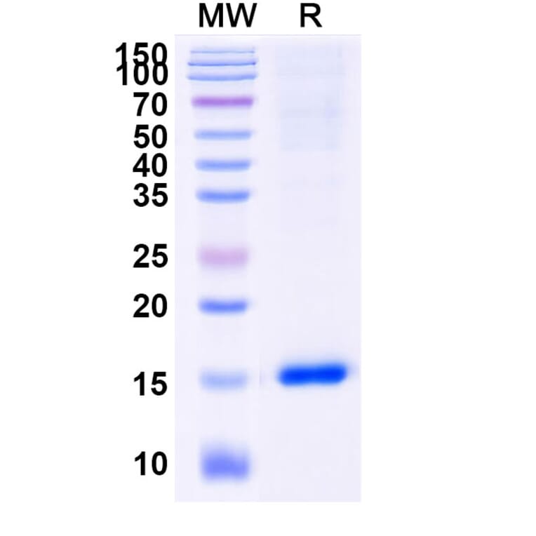 SDS-PAGE - Anti-Caspase-3 Nanobody [VHH2] (A338339) - Antibodies.com