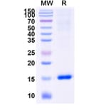 SDS-PAGE - Anti-Caspase-3 Nanobody [VHH2] (A338339) - Antibodies.com