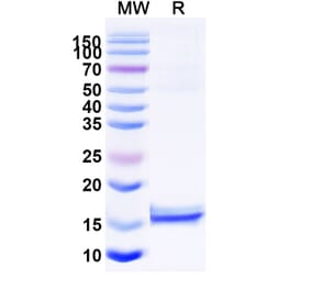 SDS-PAGE - Anti-CD72 Nanobody [NbD4] (A338341) - Antibodies.com