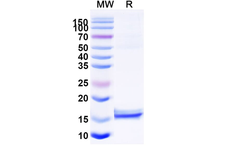 SDS-PAGE - Anti-CD72 Nanobody [NbD4] (A338341) - Antibodies.com