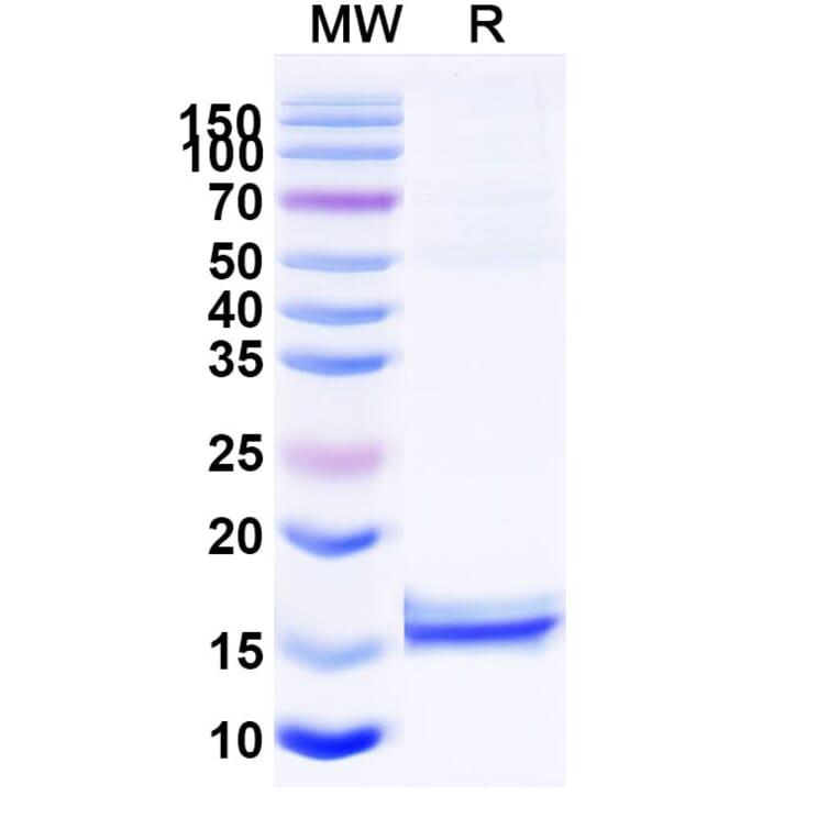 SDS-PAGE - Anti-CD72 Nanobody [NbD4] (A338341) - Antibodies.com