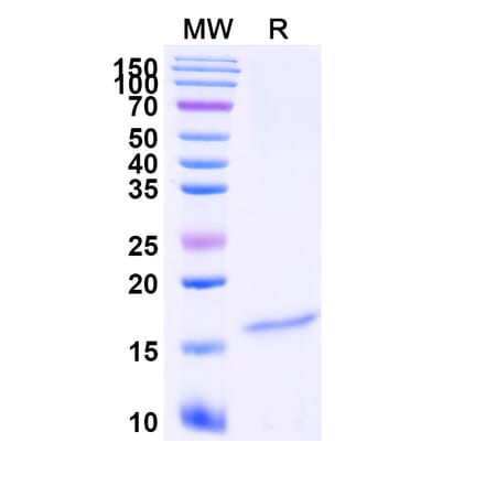 SDS-PAGE - Anti-Galectin-7 Nanobody [Nb216] (A338342) - Antibodies.com