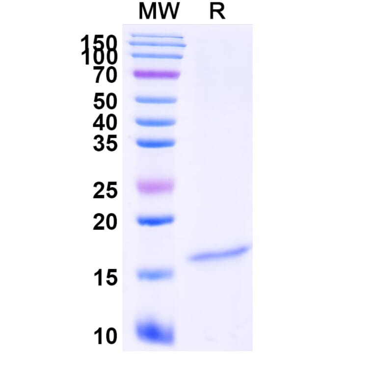 SDS-PAGE - Anti-Galectin-7 Nanobody [Nb216] (A338342) - Antibodies.com