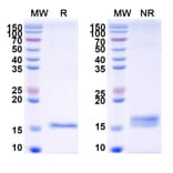 Dose-response - Anti-Galectin-7 Nanobody [Nb216] (A338342) - Antibodies.com