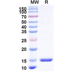 SDS-PAGE - Anti-TIM 3 Nanobody [R53] (A338343) - Antibodies.com