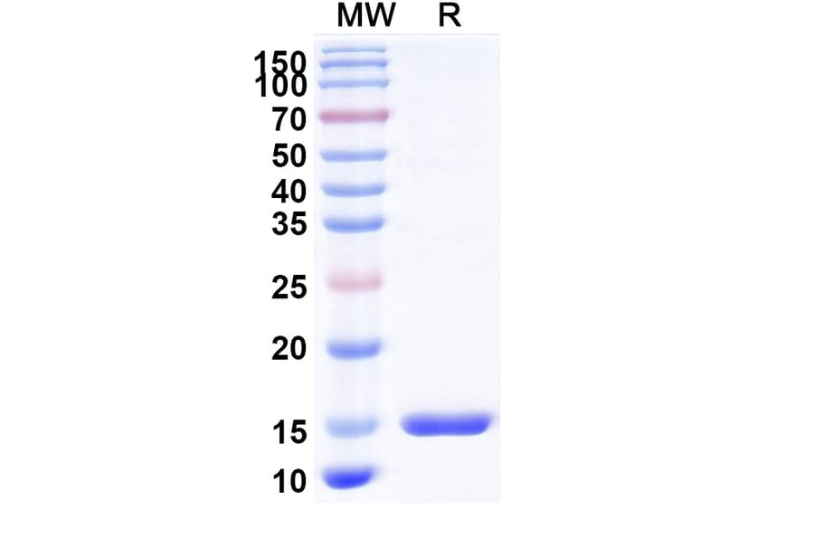 SDS-PAGE - Anti-TIM 3 Nanobody [R53] (A338343) - Antibodies.com