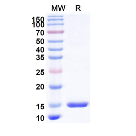 SDS-PAGE - Anti-TIM 3 Nanobody [R53] (A338343) - Antibodies.com
