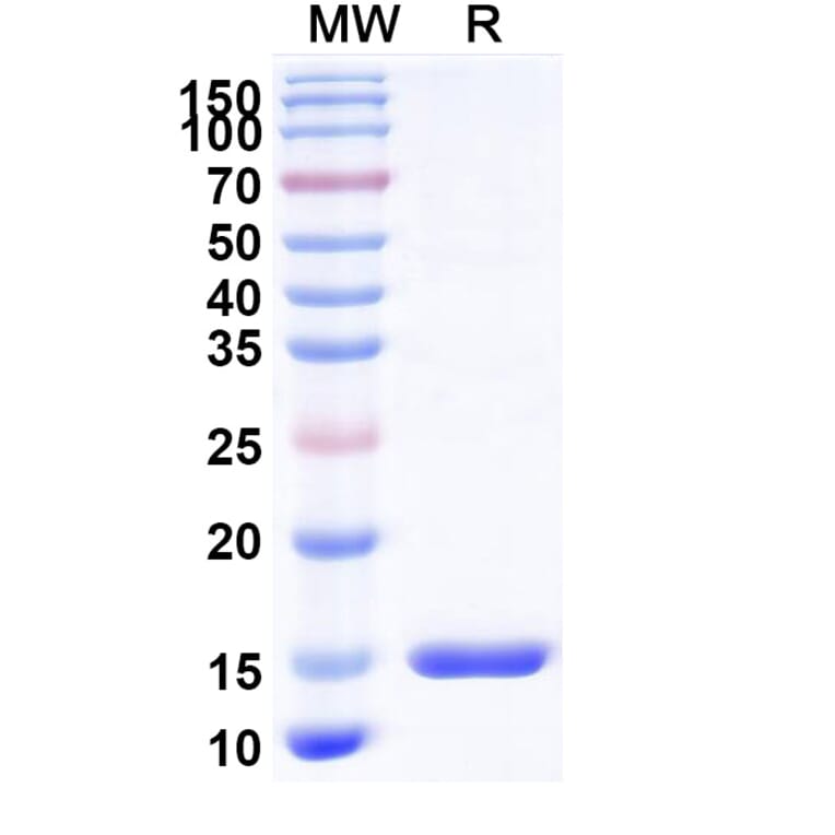 SDS-PAGE - Anti-TIM 3 Nanobody [R53] (A338343) - Antibodies.com