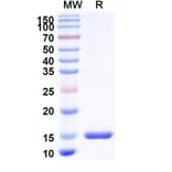 SDS-PAGE - Anti-TIM 3 Nanobody [R53] (A338343) - Antibodies.com