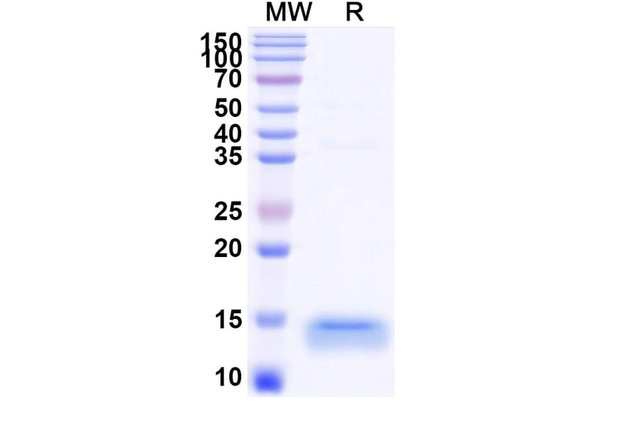 SDS-PAGE - Anti-TIM 3 Nanobody [R53] (A338343) - Antibodies.com