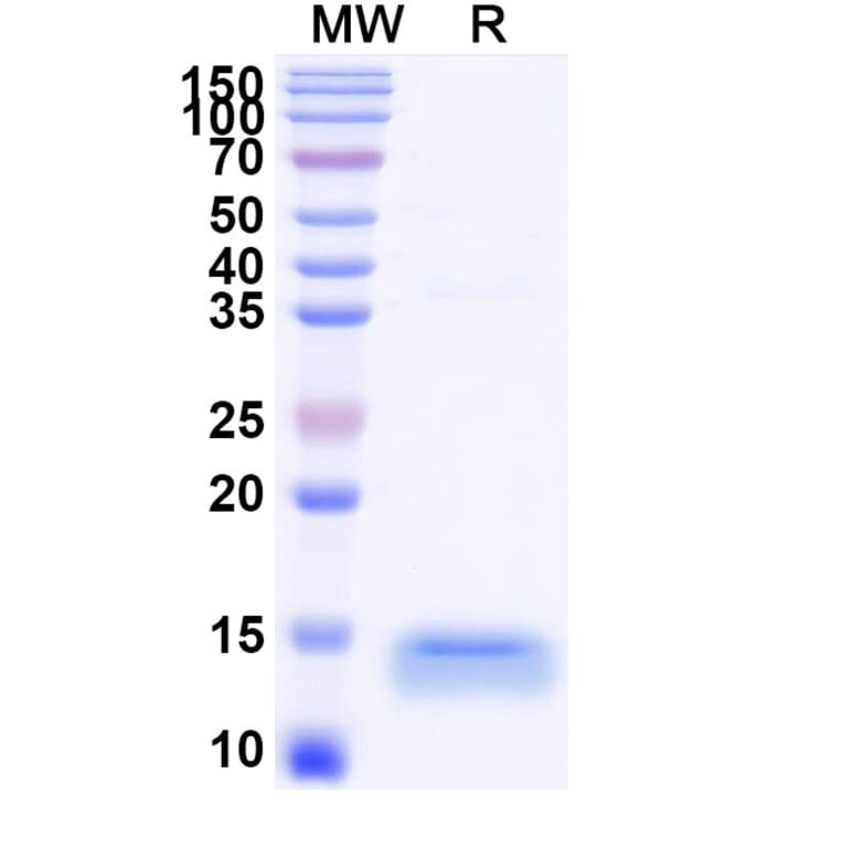 SDS-PAGE - Anti-TIM 3 Nanobody [R53] (A338343) - Antibodies.com