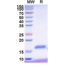 SDS-PAGE - Anti-NKp30 Nanobody [VHH2] (A338344) - Antibodies.com