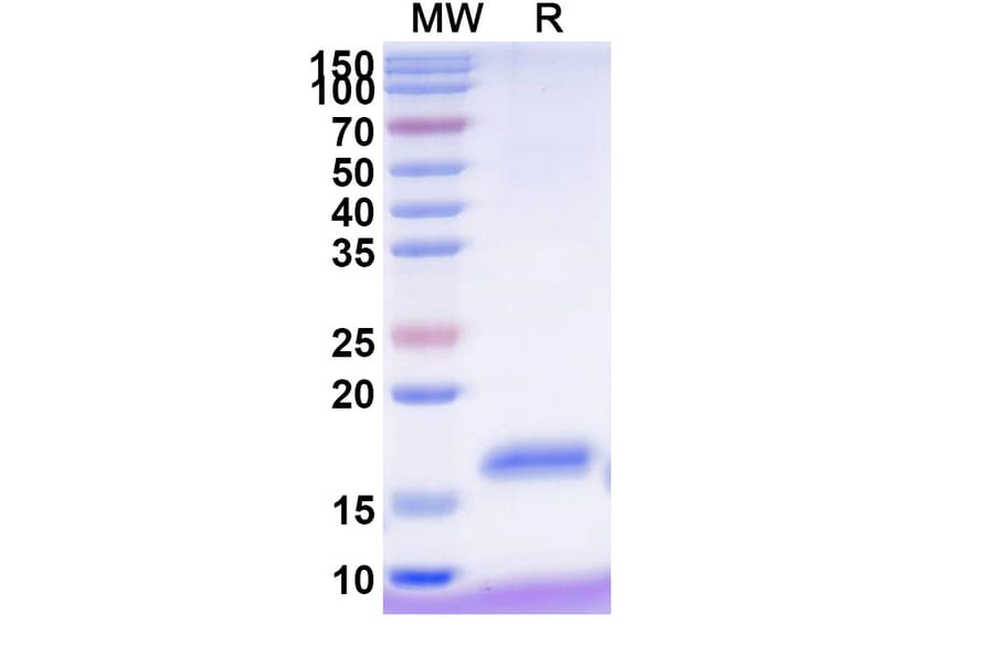 SDS-PAGE - Anti-NKp30 Nanobody [VHH2] (A338344) - Antibodies.com
