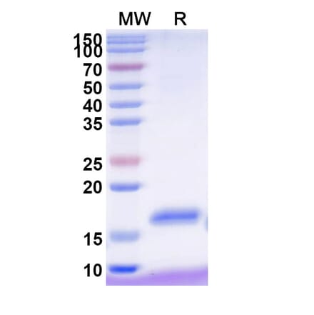 SDS-PAGE - Anti-NKp30 Nanobody [VHH2] (A338344) - Antibodies.com