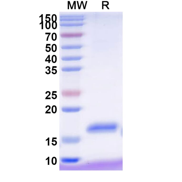 SDS-PAGE - Anti-NKp30 Nanobody [VHH2] (A338344) - Antibodies.com