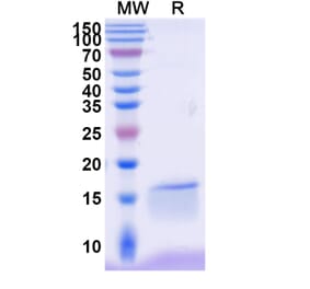 SDS-PAGE - Anti-NKp30 Nanobody [VHH1] (A338345) - Antibodies.com