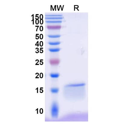 SDS-PAGE - Anti-NKp30 Nanobody [VHH1] (A338345) - Antibodies.com
