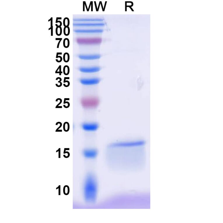 SDS-PAGE - Anti-NKp30 Nanobody [VHH1] (A338345) - Antibodies.com