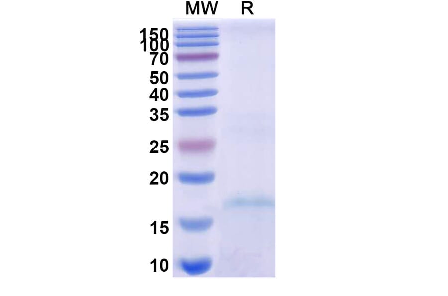 SDS-PAGE - Anti-NKp30 Nanobody [VHH1] (A338345) - Antibodies.com