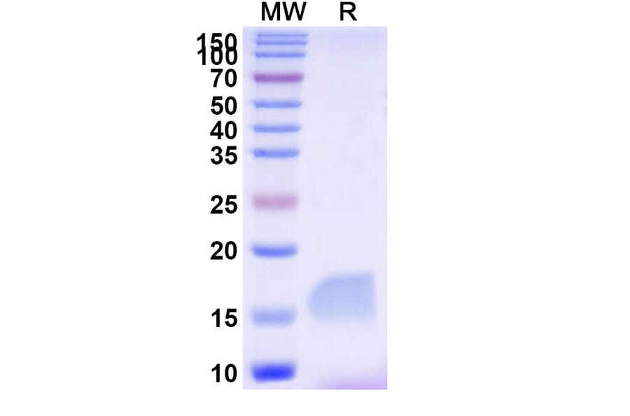 SDS-PAGE - Anti-LAG 3 Nanobody [SAA2195] (A338347) - Antibodies.com