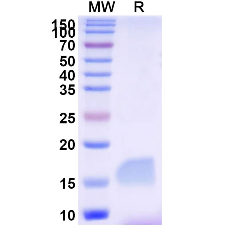 SDS-PAGE - Anti-LAG 3 Nanobody [SAA2195] (A338347) - Antibodies.com