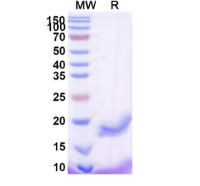 SDS-PAGE - Anti-B7-H3 Nanobody [SAA2193] (A338348) - Antibodies.com