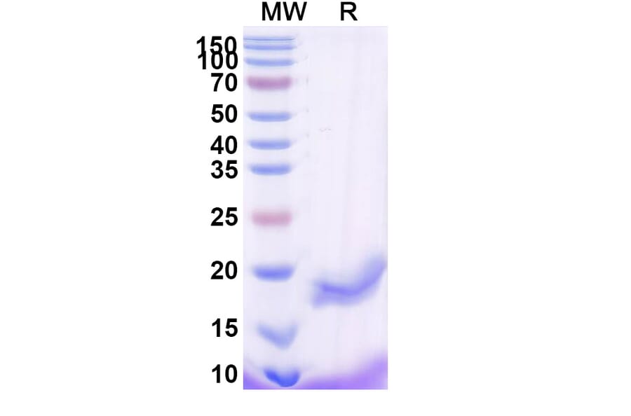 SDS-PAGE - Anti-B7-H3 Nanobody [SAA2193] (A338348) - Antibodies.com