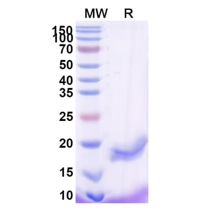 SDS-PAGE - Anti-B7-H3 Nanobody [SAA2193] (A338348) - Antibodies.com
