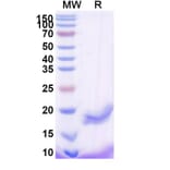 SDS-PAGE - Anti-B7-H3 Nanobody [SAA2193] (A338348) - Antibodies.com