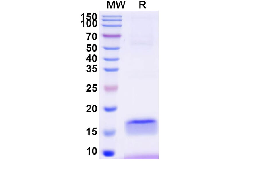 SDS-PAGE - Anti-B7-H3 Nanobody [SAA2193] (A338348) - Antibodies.com