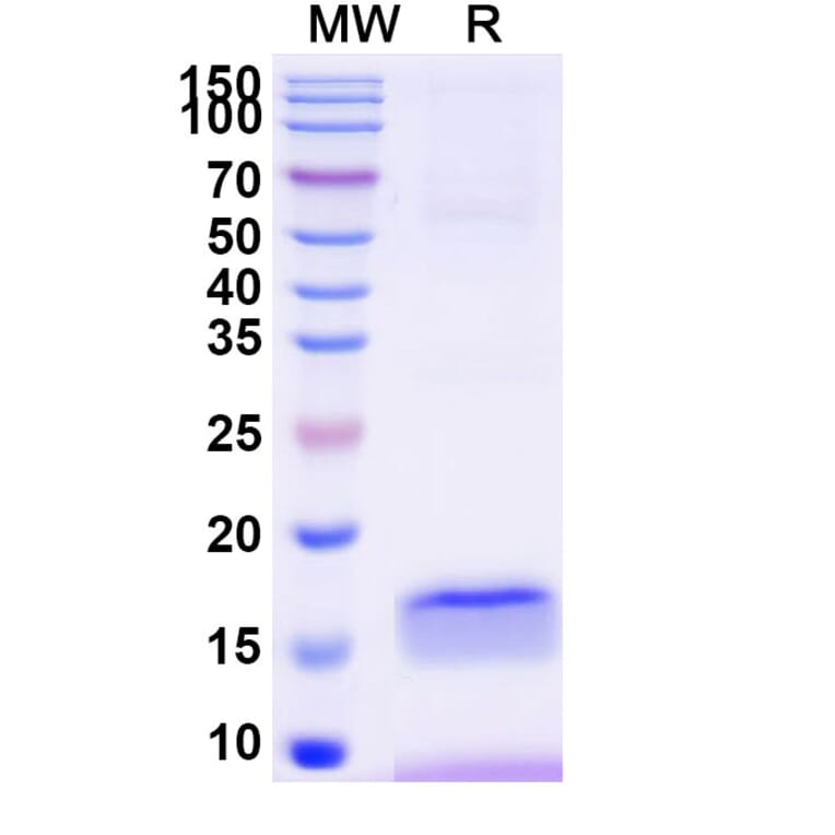 SDS-PAGE - Anti-B7-H3 Nanobody [SAA2193] (A338348) - Antibodies.com