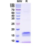 SDS-PAGE - Anti-B7-H3 Nanobody [SAA2193] (A338348) - Antibodies.com