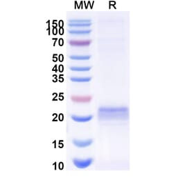 SDS-PAGE - Anti-ARC Nanobody [E5#] (A338352) - Antibodies.com