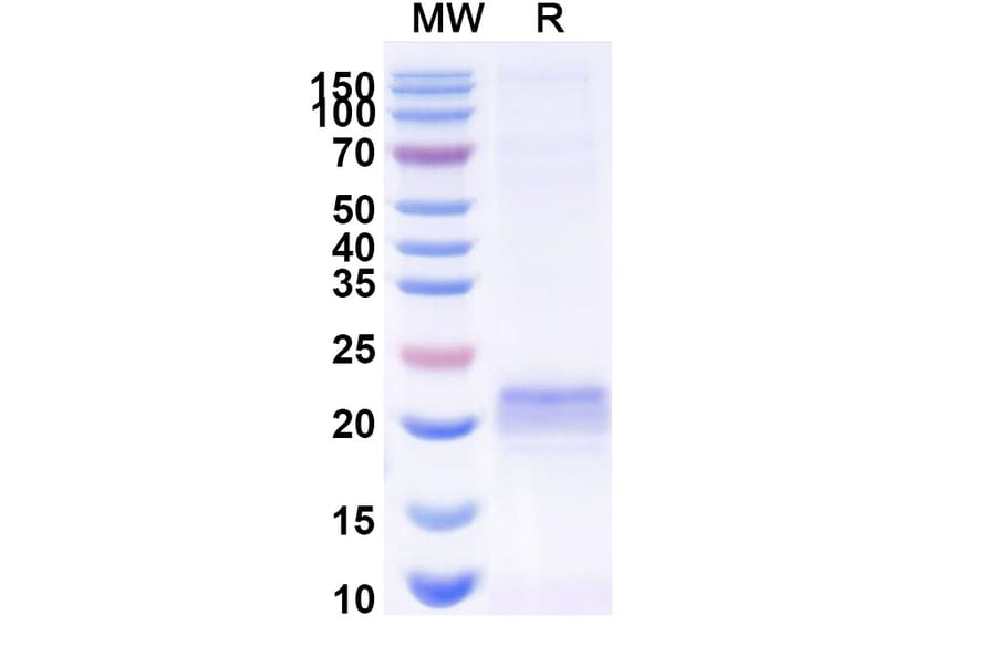 SDS-PAGE - Anti-ARC Nanobody [E5#] (A338352) - Antibodies.com