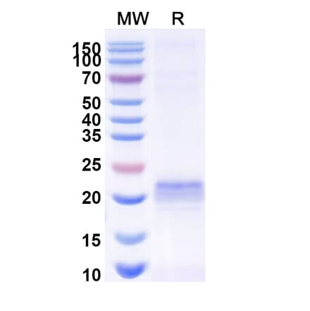 SDS-PAGE - Anti-ARC Nanobody [E5#] (A338352) - Antibodies.com