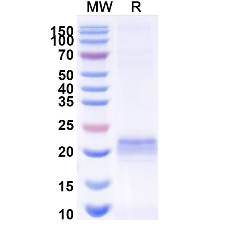 SDS-PAGE - Anti-ARC Nanobody [E5#] (A338352) - Antibodies.com