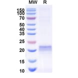 SDS-PAGE - Anti-ARC Nanobody [E5#] (A338352) - Antibodies.com