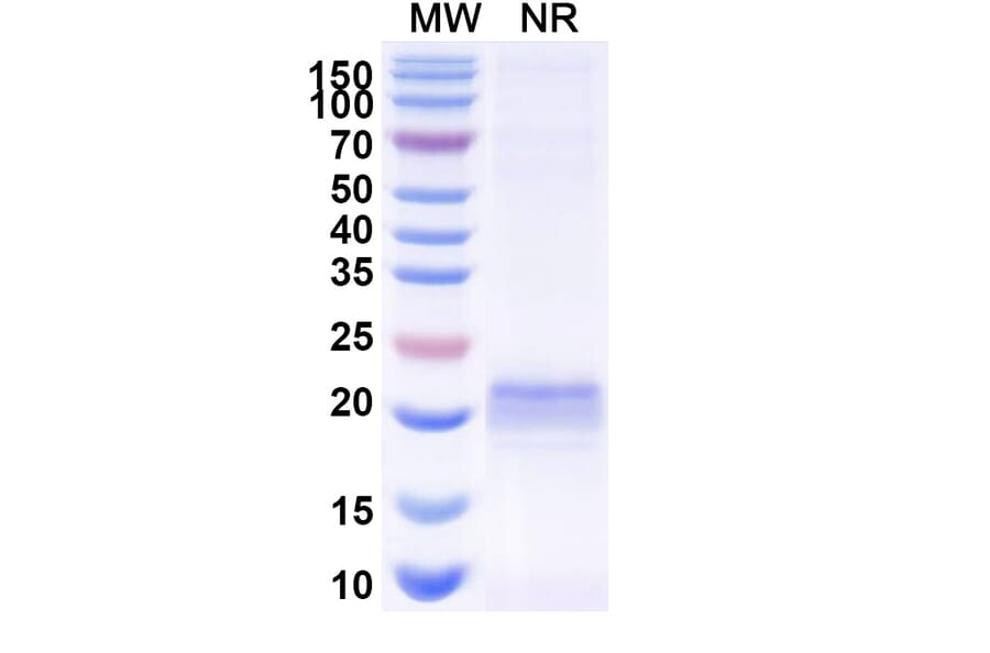 SDS-PAGE - Anti-ARC Nanobody [E5#] (A338352) - Antibodies.com