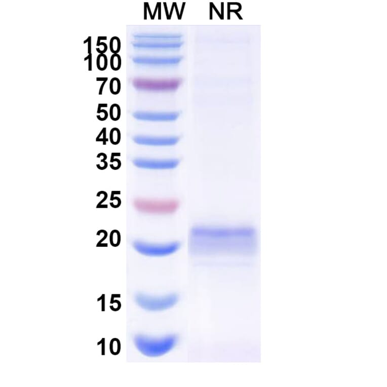 SDS-PAGE - Anti-ARC Nanobody [E5#] (A338352) - Antibodies.com