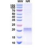 SDS-PAGE - Anti-ARC Nanobody [E5#] (A338352) - Antibodies.com
