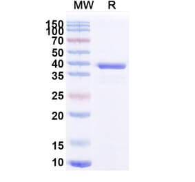 SDS-PAGE - Anti-ATP7B Nanobody [2R21] (A338353) - Antibodies.com