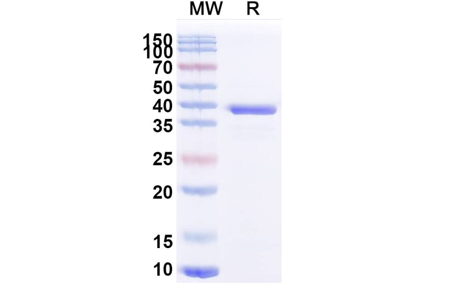 SDS-PAGE - Anti-ATP7B Nanobody [2R21] (A338353) - Antibodies.com