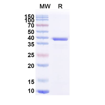SDS-PAGE - Anti-ATP7B Nanobody [2R21] (A338353) - Antibodies.com