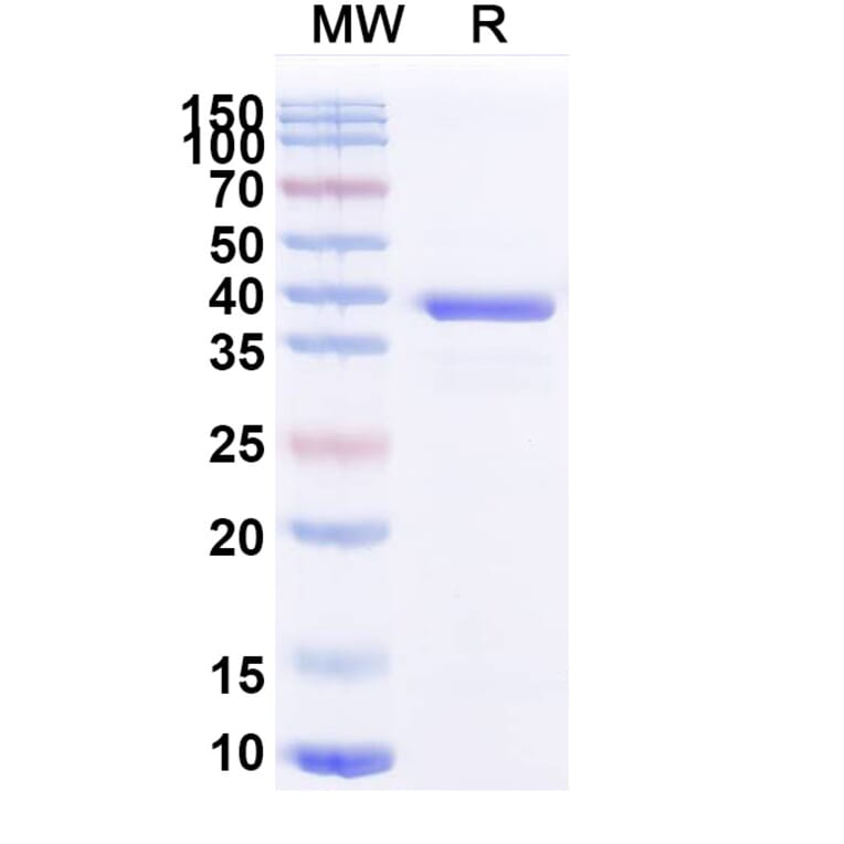 SDS-PAGE - Anti-ATP7B Nanobody [2R21] (A338353) - Antibodies.com