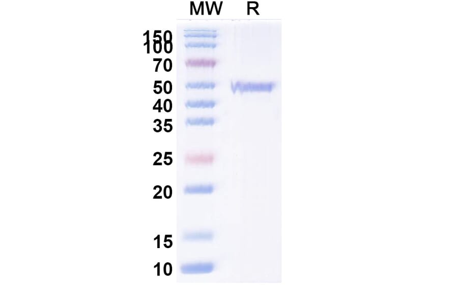 SDS-PAGE - Anti-ATP7B Nanobody [2R50] (A338354) - Antibodies.com