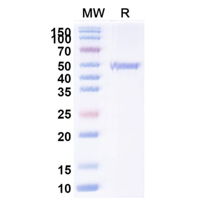 SDS-PAGE - Anti-ATP7B Nanobody [2R50] (A338354) - Antibodies.com