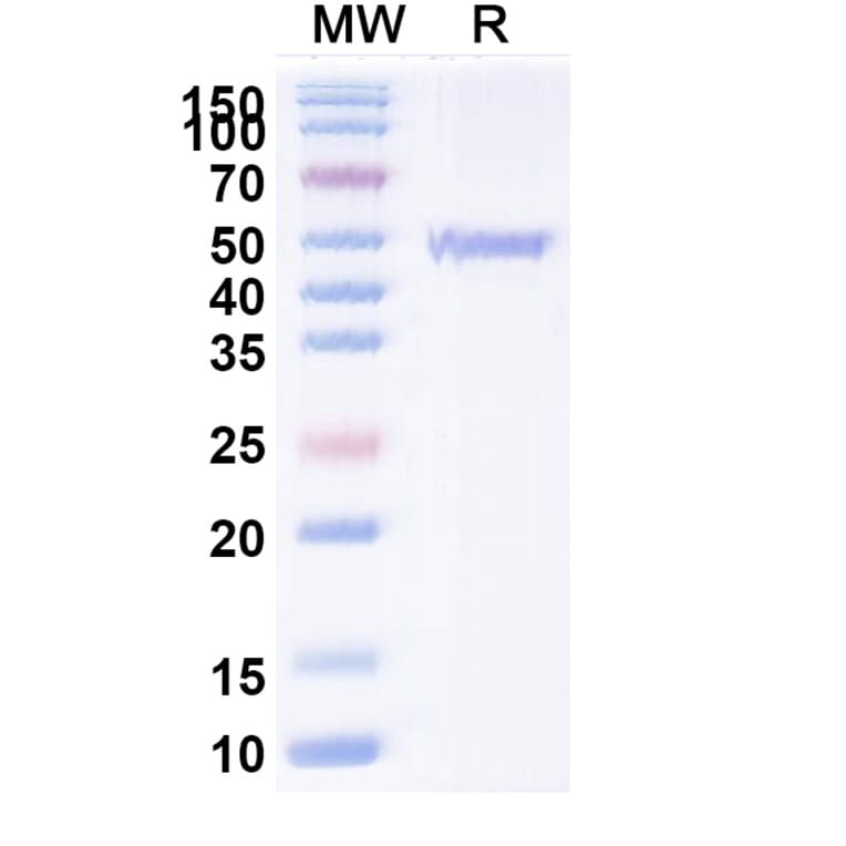 SDS-PAGE - Anti-ATP7B Nanobody [2R50] (A338354) - Antibodies.com